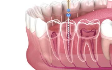 Formation Endodontie