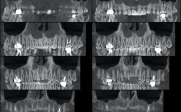 Formation Cone Beam